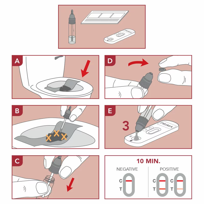 Schritt-für-Schritt-Anleitung zur Anwendung eines Heimtests zum Nachweis von Helicobacter pylori im Stuhl zur Magengesundheitsvorsorge.