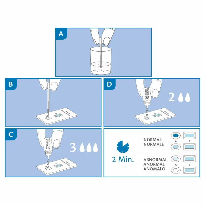 Grafische Anleitung für den PRIMA Home Test Spermientest: Probenentnahme, Auftrag auf Testkassette, Zugabe der Lösungen und Ergebnisinterpretation nach 2 Minuten