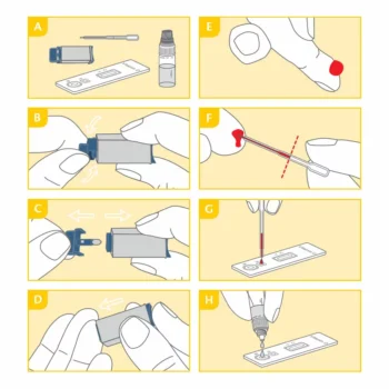 Grafische Anleitung zur Durchführung des PRIMA Vitamin D Selbsttests: Vorbereitung, Blutentnahme aus der Fingerkuppe, Auftragen der Probe und Zugabe der Testlösung.